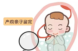 贵州省怀胎期间怎么做胎儿亲子鉴定，在贵州省做无创胎儿亲子鉴定价钱